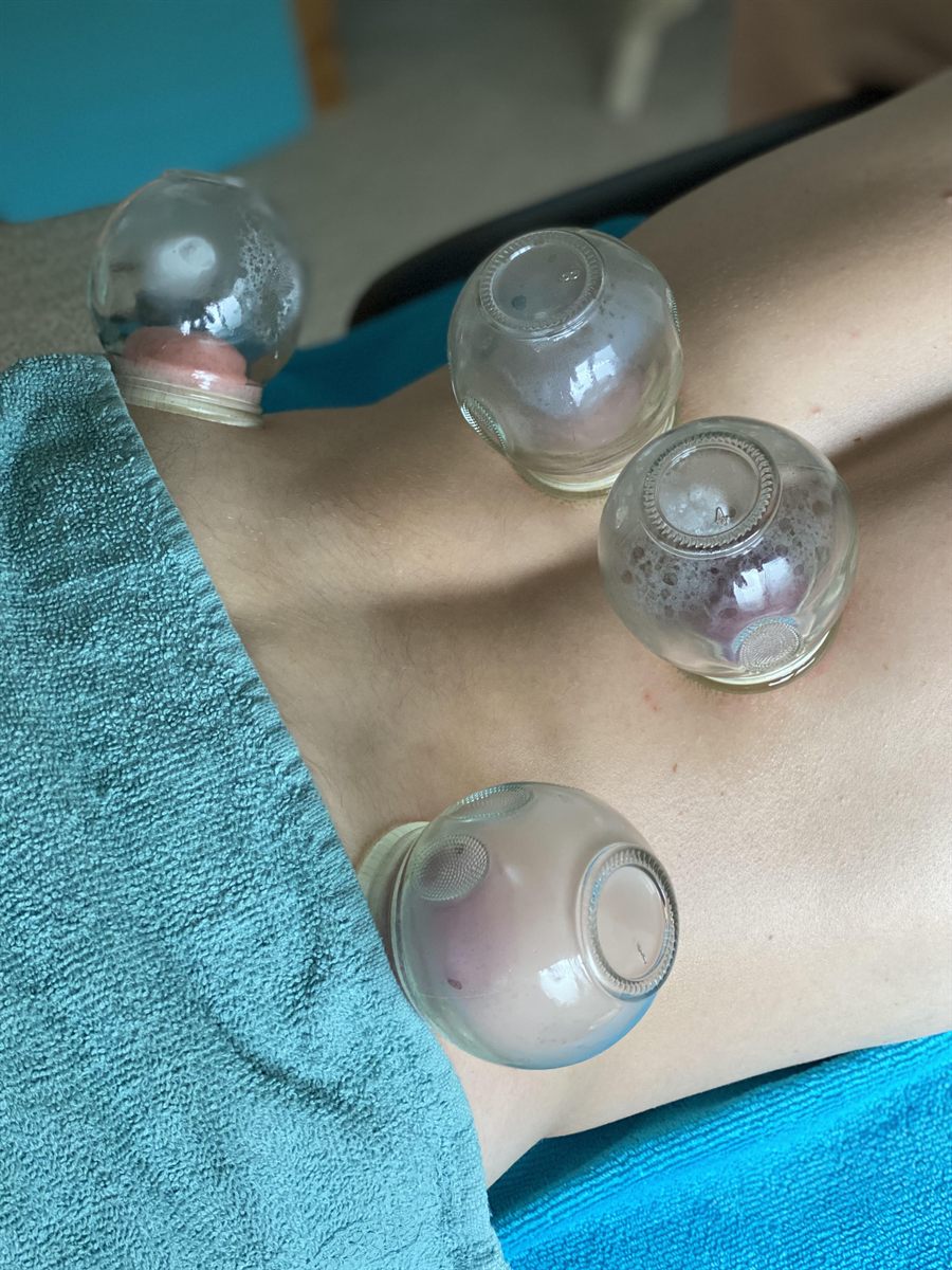 Glazen cups geplaatst op de rug van een cliënt tijdens de behandeling
